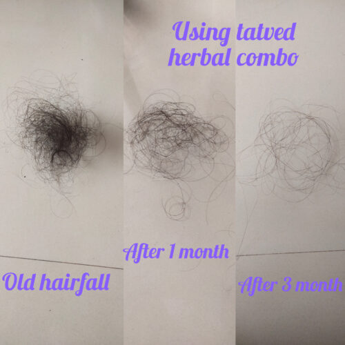 Complete Hair Care Combo by Tatved Herbal photo review