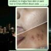 Anti Pigmentation Combo by Tatved Herbal