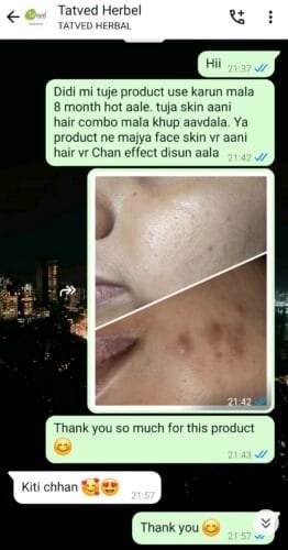 Anti Pigmentation Combo by Tatved Herbal photo review