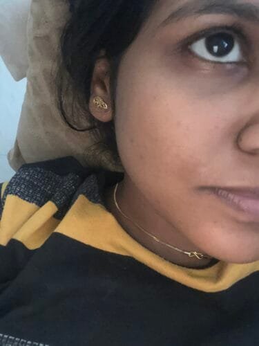 Anti Pigmentation Combo by Tatved Herbal photo review