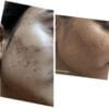 Anti Pigmentation Combo by Tatved Herbal