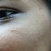 Anti Pigmentation Combo by Tatved Herbal