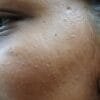 Anti Pigmentation Combo by Tatved Herbal