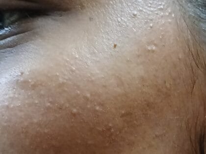 Anti Pigmentation Combo by Tatved Herbal photo review