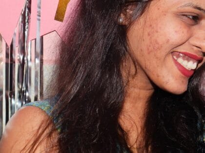 Anti Pigmentation Combo by Tatved Herbal photo review