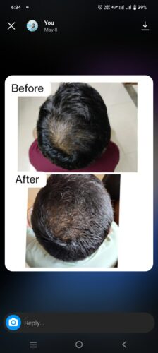 Scalp Strengthening Combo by Tatved Herbal photo review