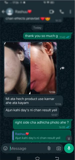 Clear Skin Transformation Review