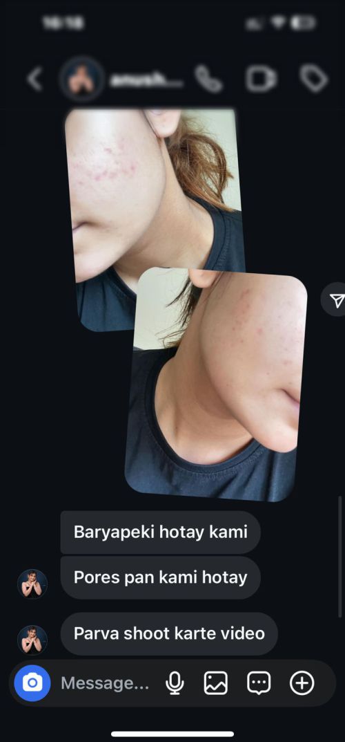 Customer Review Skin Product 1