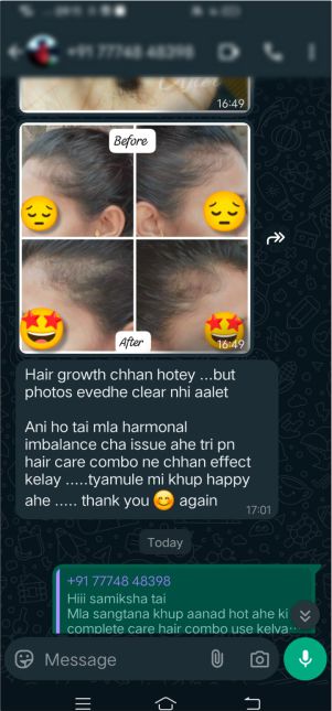 Hair Thickness Before & After Review