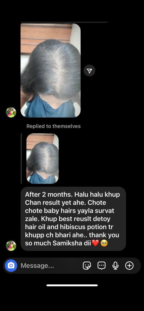 hair Growth product