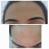 Travel kit for Oily to combination skin by Tatved Herbal