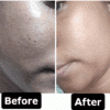 CTM Routine for oily-Combination and normal Skin
