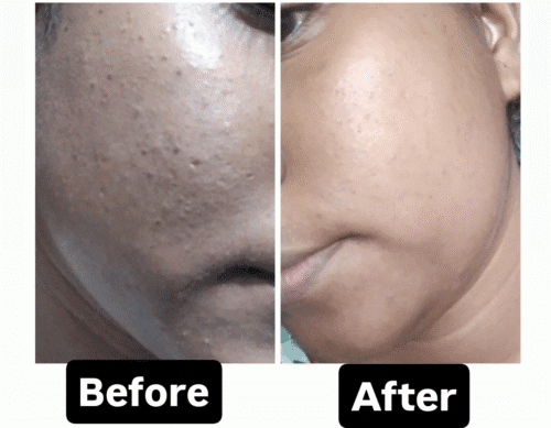 CTM Routine for oily-Combination and normal Skin photo review