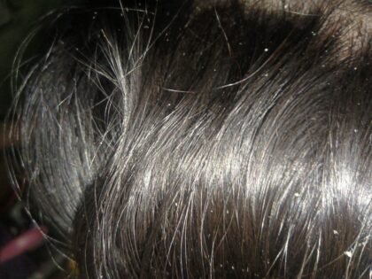 Complete Hair Care Combo by Tatved Herbal photo review