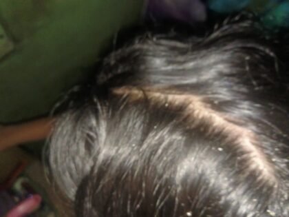 Complete Hair Care Combo by Tatved Herbal photo review