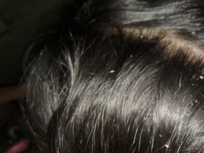 Complete Hair Care Combo by Tatved Herbal photo review